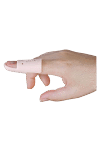 mallet finger parmak ateli 1